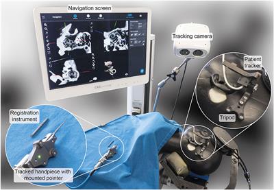 Freehand Stereotactic Image-Guidance Tailored to Neurotologic Surgery